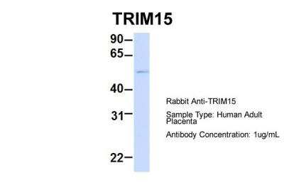 Western Blot: TRIM15 Antibody [NBP2-82361]