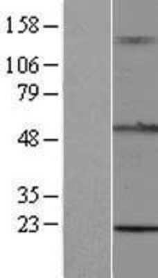 Western Blot: TRIM15 Overexpression Lysate [NBL1-17278]