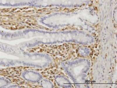 Immunohistochemistry-Paraffin: TRIM16 Antibody (5G11) [H00010626-M02]