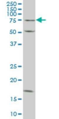 Western Blot: TRIM16 Antibody (5G11) [H00010626-M02]