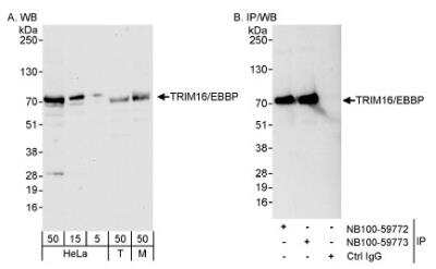 Western Blot: TRIM16 Antibody [NB100-59772]