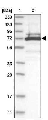 Western Blot: TRIM16 Antibody [NBP1-84921]
