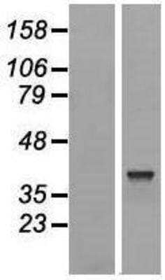 Western Blot: TRIM16L Overexpression Lysate [NBL1-17279]