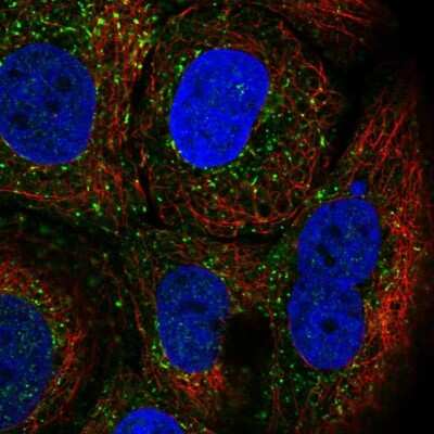 Immunocytochemistry/ Immunofluorescence: TRIM17 Antibody [NBP2-49156]