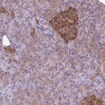 Immunohistochemistry: TRIM17 Antibody [NBP2-49156]