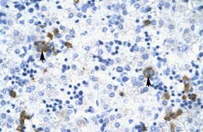 Immunohistochemistry-Paraffin: TRIM17 Antibody [NBP1-80043]