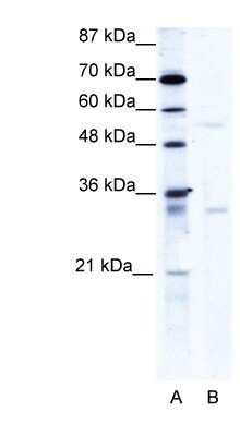 Western Blot: TRIM17 Antibody [NBP1-80044]