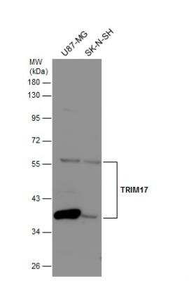 Western Blot: TRIM17 Antibody [NBP2-20708]