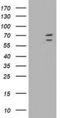 Western Blot: TRIM2 Antibody (OTI2B10) [NBP2-02928]