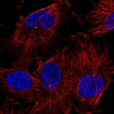 Immunocytochemistry/ Immunofluorescence: TRIM2 Antibody [NBP1-81504]