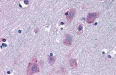 Immunohistochemistry-Paraffin: TRIM2 Antibody [NB100-1218]