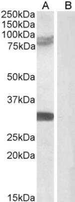 Western Blot: TRIM2 Antibody [NB100-1218]