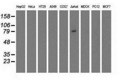 Western Blot: TRIM2 Antibody (OTI2B10)Azide and BSA Free [NBP2-74606]