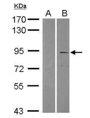 Western Blot: TRIM2 Antibody [NBP2-20709]