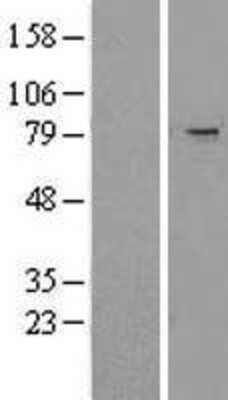 Western Blot: TRIM2 Overexpression Lysate [NBL1-17280]