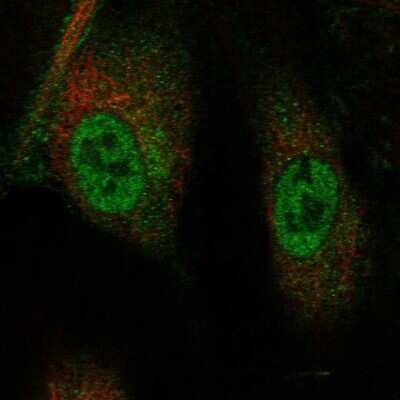 Immunocytochemistry/ Immunofluorescence: TRIM21/SSA1 Antibody [NBP1-87122]