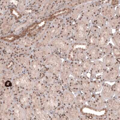 Immunohistochemistry-Paraffin: TRIM21/SSA1 Antibody [NBP1-87122]
