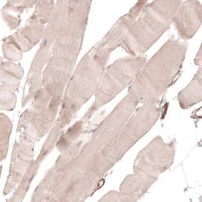 Immunohistochemistry-Paraffin: TRIM21/SSA1 Antibody [NBP1-87122]