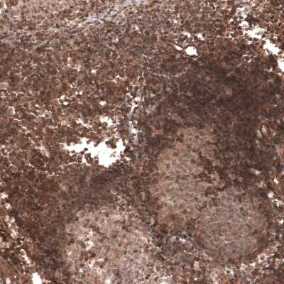 Immunohistochemistry-Paraffin: TRIM21/SSA1 Antibody [NBP1-87122]