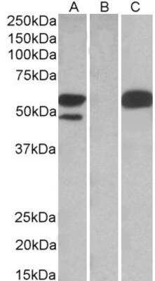 Western Blot: TRIM21/SSA1 Antibody [NB100-1209]