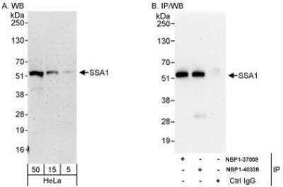 Western Blot: TRIM21/SSA1 Antibody [NBP1-40338]