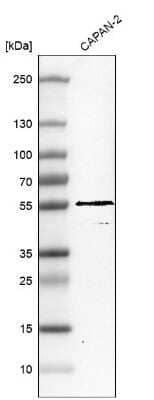 Western Blot: TRIM21/SSA1 Antibody [NBP1-87122]