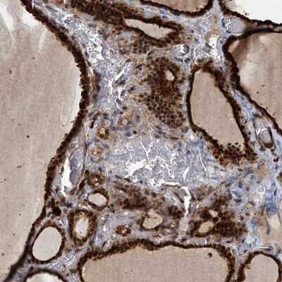 Immunohistochemistry-Paraffin: TRIM23 Antibody [NBP1-88846]