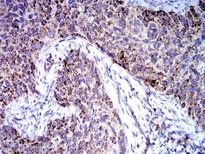 Immunohistochemistry: TRIM25 Antibody (5B5B10) - BSA Free [NBP2-61820]