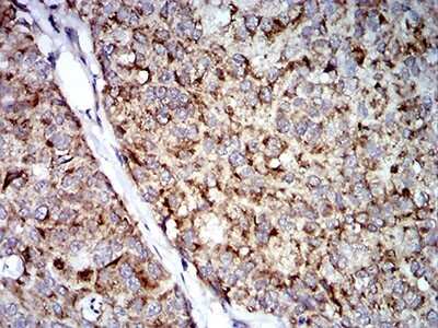 Immunohistochemistry: TRIM25 Antibody (5B5B12) - BSA Free [NBP2-61814]