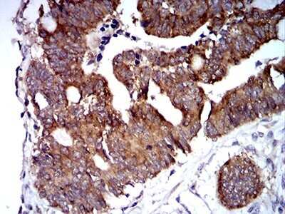 Immunohistochemistry: TRIM25 Antibody (5B5B12) - BSA Free [NBP2-61814]