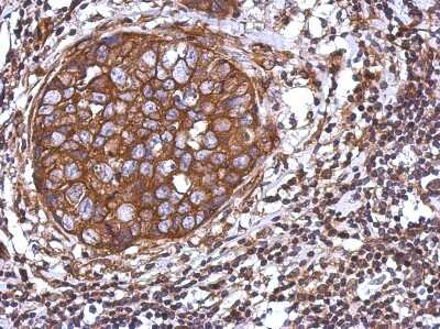 Immunohistochemistry-Paraffin: TRIM25 Antibody [NBP1-32050]
