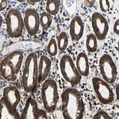 Immunohistochemistry-Paraffin: TRIM25 Antibody [NBP1-84891]