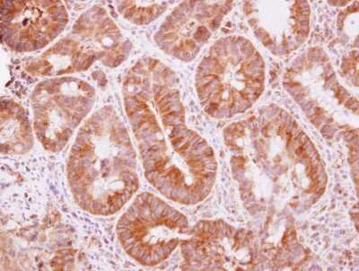 Immunohistochemistry-Paraffin: TRIM25 Antibody [NBP2-20710]
