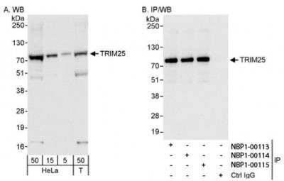 Western Blot: TRIM25 Antibody [NBP1-00113]