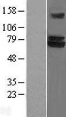 Western Blot: TRIM25 Overexpression Lysate [NBL1-17285]