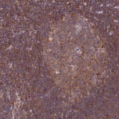 Immunohistochemistry-Paraffin: TRIM26 Antibody [NBP2-47595]