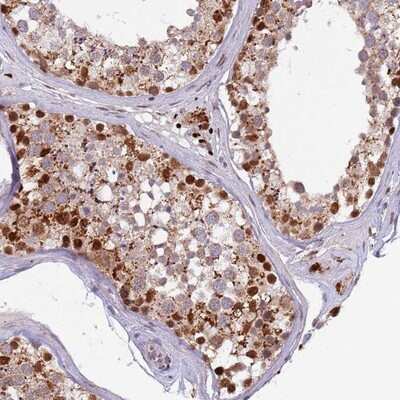 Immunohistochemistry-Paraffin: TRIM27 Antibody [NBP2-13482]