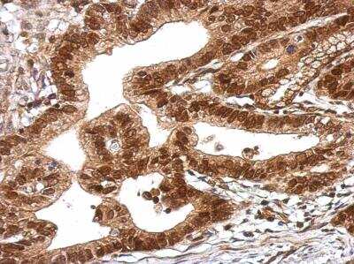 Immunohistochemistry-Paraffin: TRIM27 Antibody [NBP2-20712]