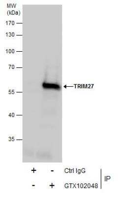 Immunoprecipitation: TRIM27 Antibody [NBP2-20711]