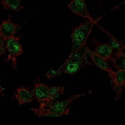 Immunocytochemistry/ Immunofluorescence: TRIM27 Antibody (PCRP-TRIM27-1B3) - Azide and BSA Free [NBP3-08579]