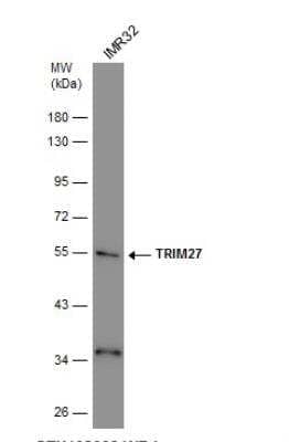 Western Blot: TRIM27 Antibody [NBP1-32098]