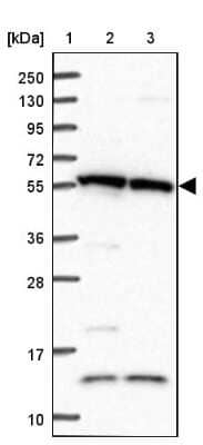 Western Blot: TRIM27 Antibody [NBP2-13482]