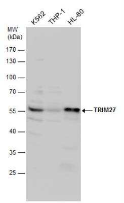 Western Blot: TRIM27 Antibody [NBP2-20711]