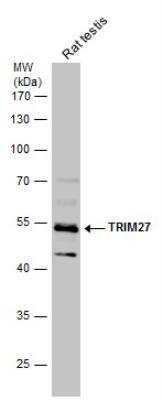 Western Blot: TRIM27 Antibody [NBP2-20711]