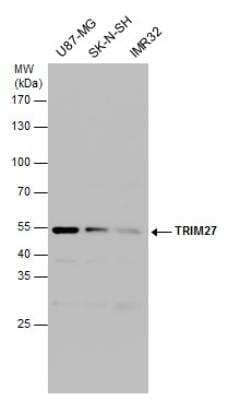 Western Blot: TRIM27 Antibody [NBP2-20711]