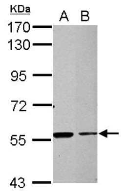 Western Blot: TRIM27 Antibody [NBP2-20712]