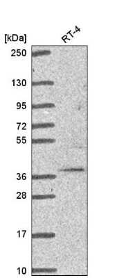 Western Blot: TRIM27 Antibody [NBP2-54993]