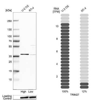 Western Blot: TRIM27 Antibody [NBP2-54993]