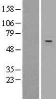 Western Blot: TRIM27 Overexpression Lysate [NBL1-17287]