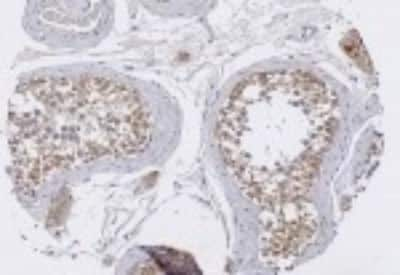 Immunohistochemistry-Paraffin: TRIM29 Antibody [NB120-22207]